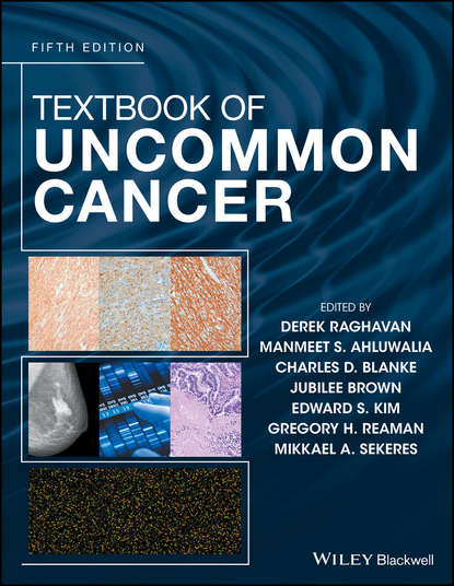 

Textbook of Uncommon Cancer