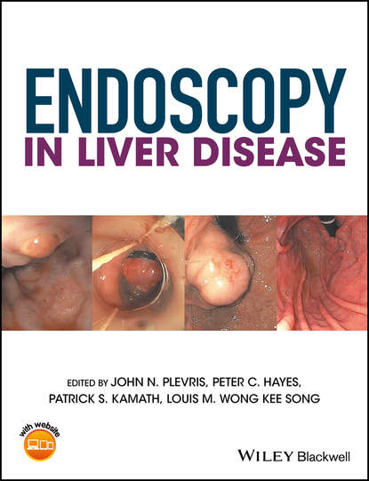 

Endoscopy in Liver Disease