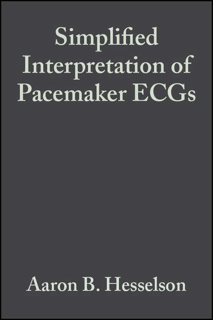 

Simplified Interpretation of Pacemaker ECGs