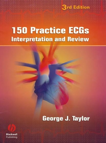 

150 Practice ECGs