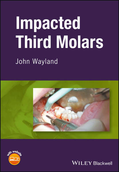 

Impacted Third Molars
