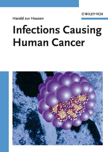 

Infections Causing Human Cancer