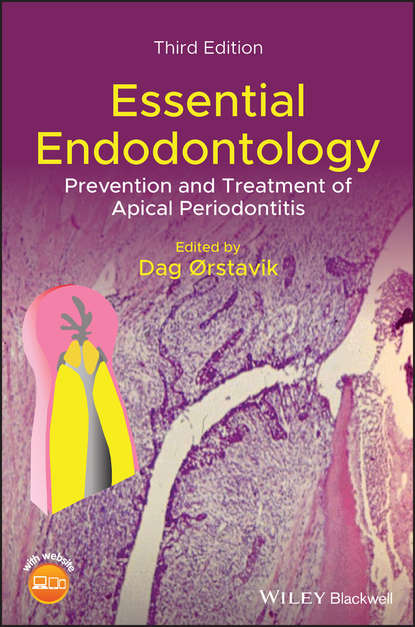 

Essential Endodontology