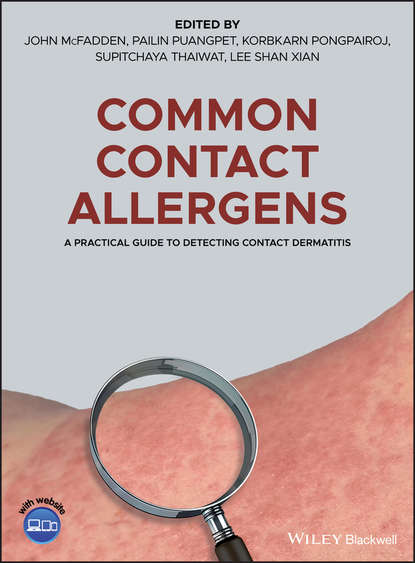 

Common Contact Allergens