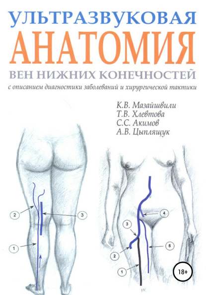 

Ультразвуковая анатомия вен нижних конечностей