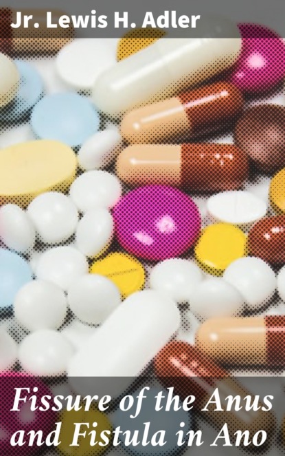 Fissure of the Anus and Fistula in Ano