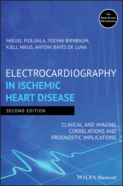 

Electrocardiography in Ischemic Heart Disease