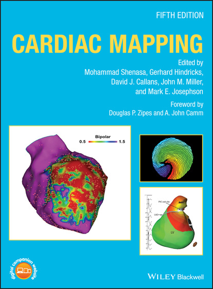 

Cardiac Mapping