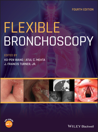 

Flexible Bronchoscopy