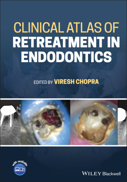 

Clinical Atlas of Retreatment in Endodontics