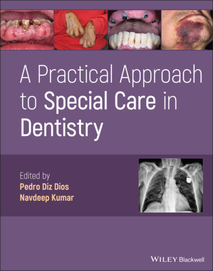 

A Practical Approach to Special Care in Dentistry