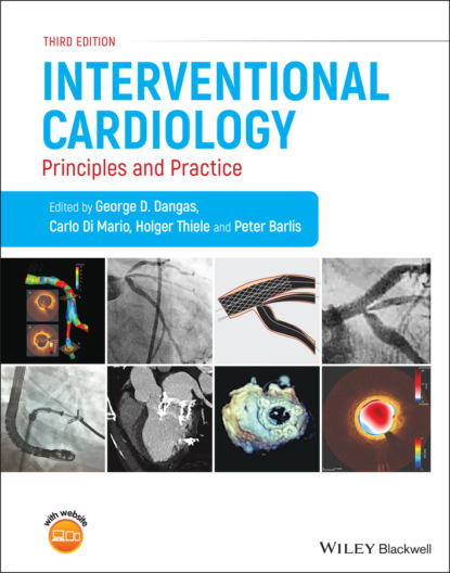 

Interventional Cardiology