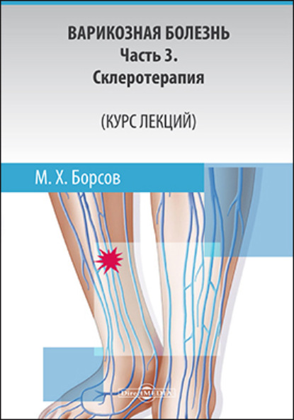 Мухамед Хамзатович Борсов — Варикозная болезнь: Часть 3