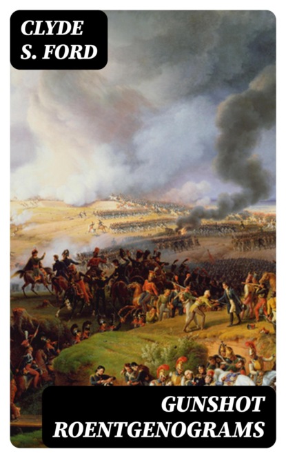 Gunshot Roentgenograms