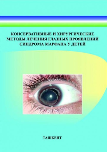 

Консервативные и хирургические методы лечения глазных проявлений синдрома марфана у детей