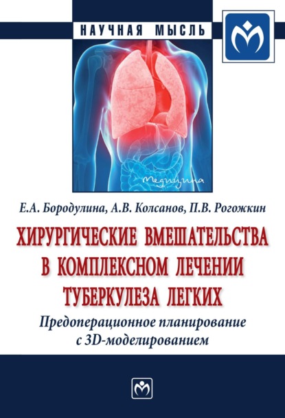 

Хирургические вмешательства в комплексном лечении туберкулеза легких. Предоперационное планирование с 3D моделированием: Монография