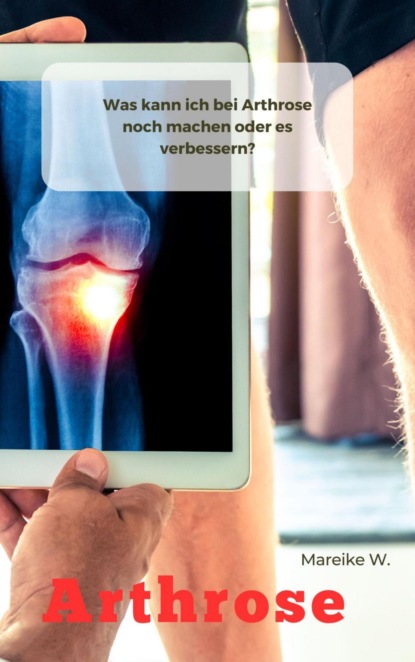 Arthrose