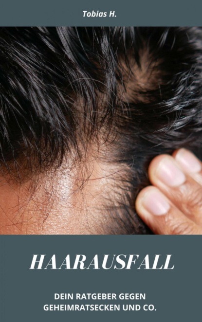 Haarausfall - dein Ratgeber gegen Geheimratsecken und Co.