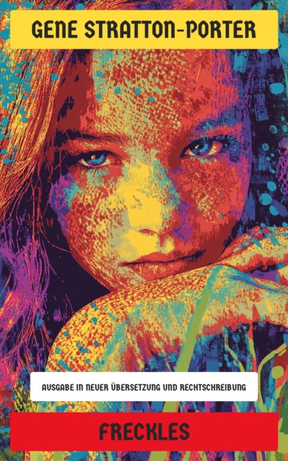 Freckles