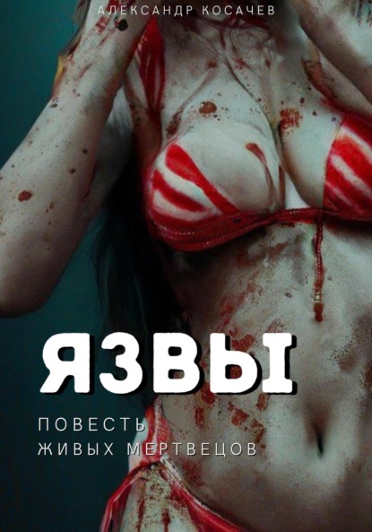 

Язвы