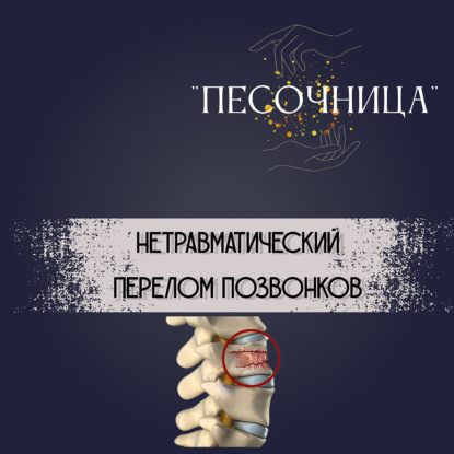 Нетравматический перелом позвонков