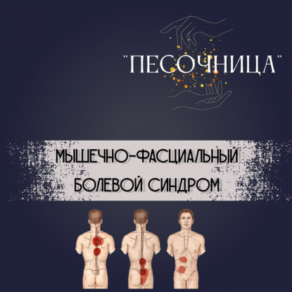 Мышечно-фасциальный болевой синдром