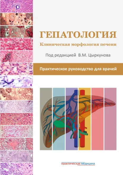 Обложка книги Гепатология. Клиническая морфология печени. Практическое руководство для врачей, В. П. Андреев