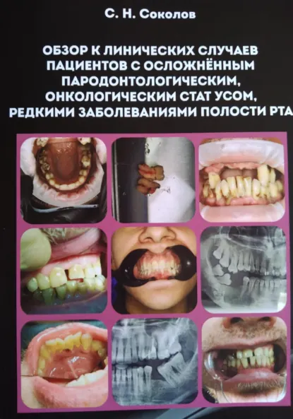 Обложка книги Обзор клинических случаев пациентов с осложнённым пародонтологическим, онкологическим статусом, редкими заболеваниями полости рта, Станислав Николаевич Соколов