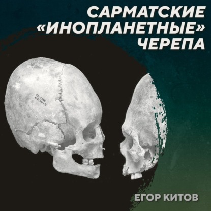РС 426 Искусственная деформация черепов у сарматов. Егор Китов