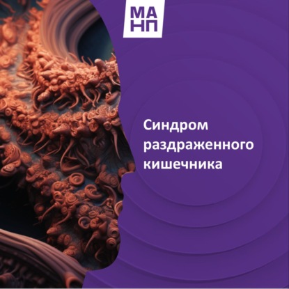 27. Синдром раздраженного кишечника