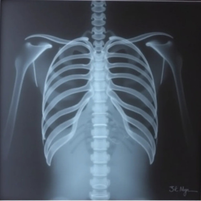 Нарушения системы эритроцитов