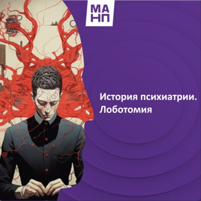 62. История психиатрии. Лоботомия