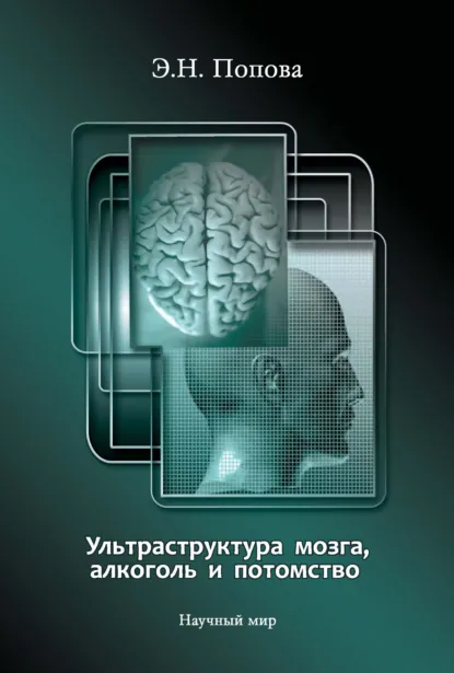 Обложка книги Ультраструктура мозга, алкоголь и потомство, Э. Н. Попова