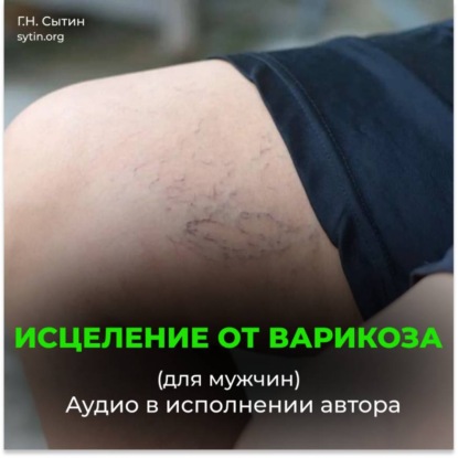 Аудиокнига «Исцеление от варикоза. Здоровые ноги. Исцеление от отека ног (для мужчин)», Георгий Сытин