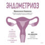 Эндометриоз. Как разобраться в причинах, распознать симптомы и позаботиться о себе