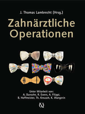 Zahnärztliche Operationen