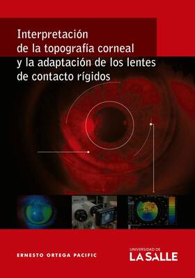 Interpretación de la topografía corneal y la adaptación de los lentes de contacto rígidos