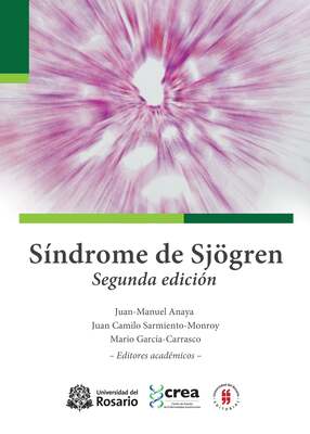 Síndrome de Sjögren