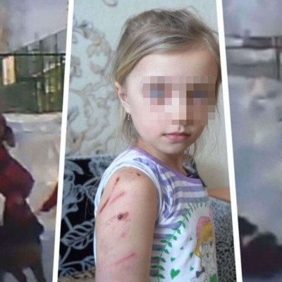 В Новосибирске собака искусала первоклассницу