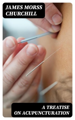 A Treatise on Acupuncturation