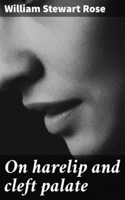 On harelip and cleft palate