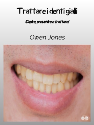 Trattare I Denti Gialli