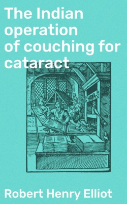 The Indian operation of couching for cataract