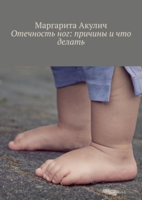 Отечность ног: причины и что делать
