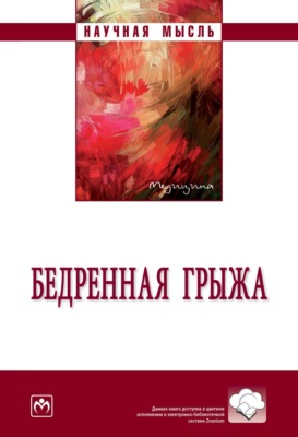 Бедренная грыжа