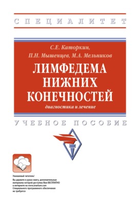 Лимфедема нижних конечностей: диагностика и лечение