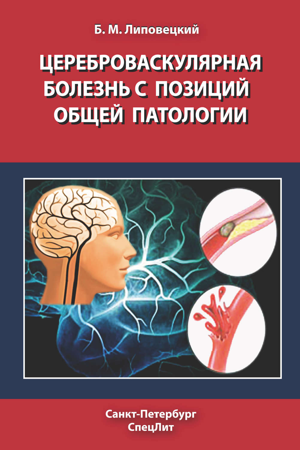 Обложка книги «Цереброваскулярная болезнь с позиций общей патологии»