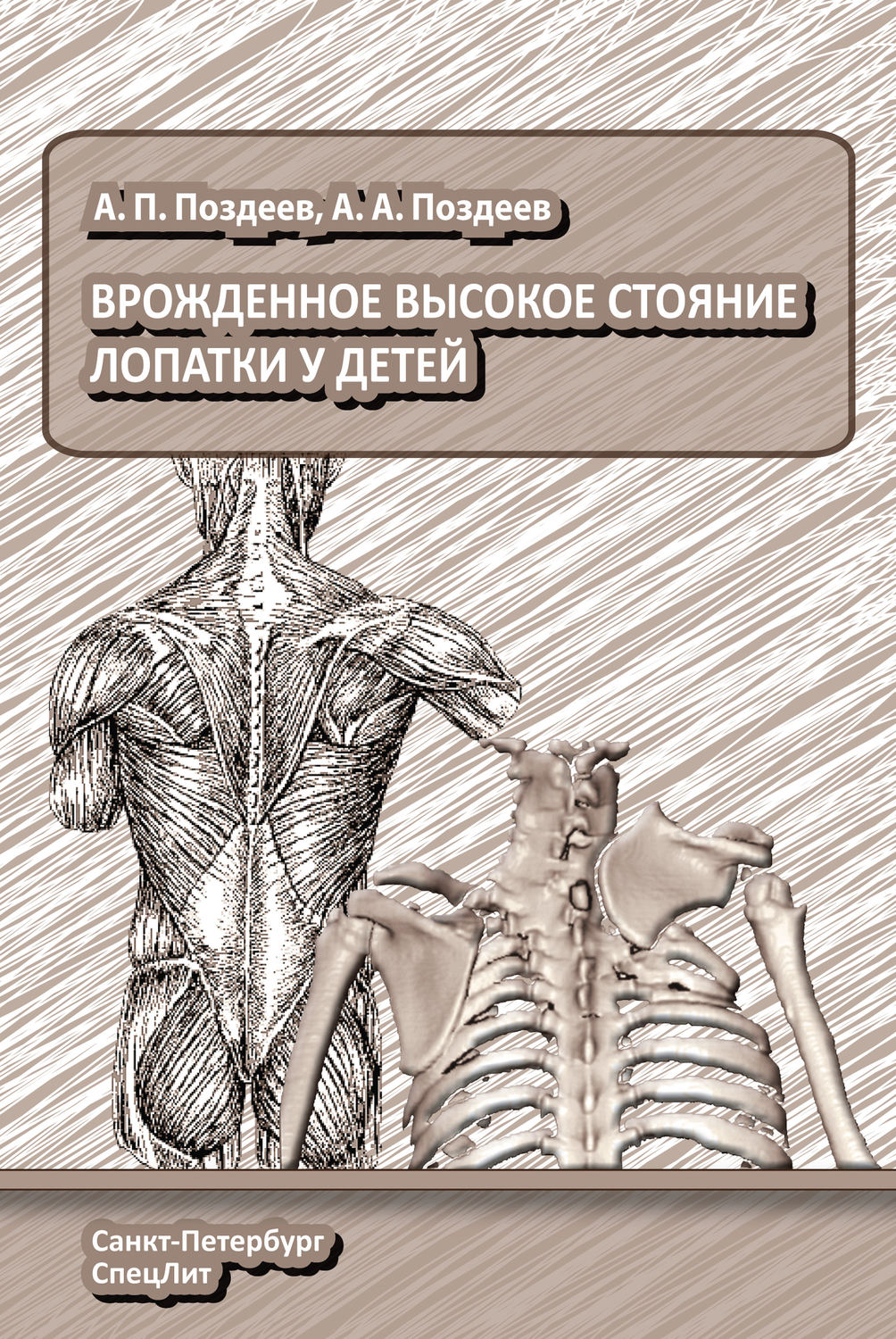 Обложка книги «Врожденное высокое стояние лопатки у детей»