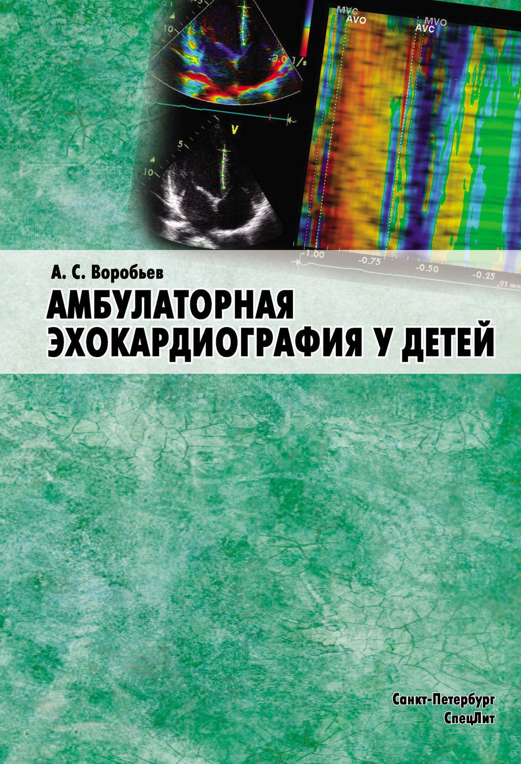 Обложка книги «Амбулаторная эхокардиография у детей»
