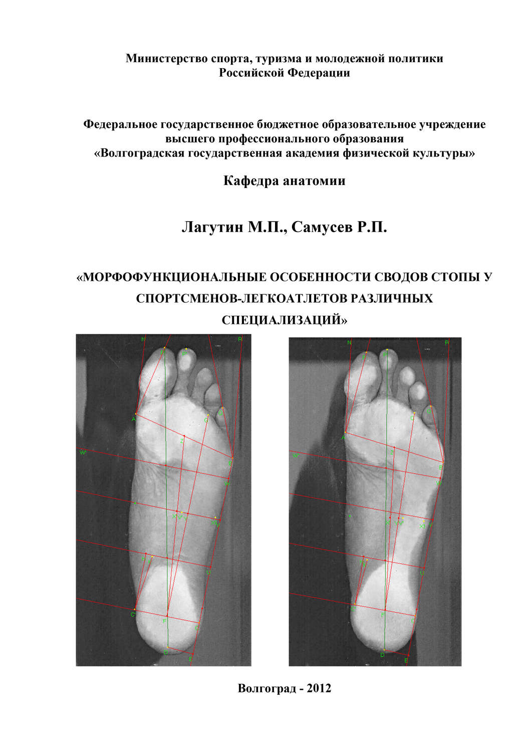 Обложка книги «Морфофункциональные особенности сводов стопы у спортсменов-легкоатлетов различных специализаций»